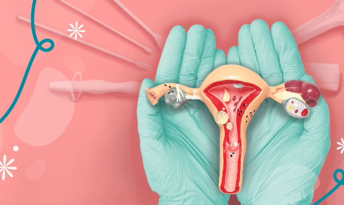 CerviCare: Actualización integral sobre Citología Cervicouterina