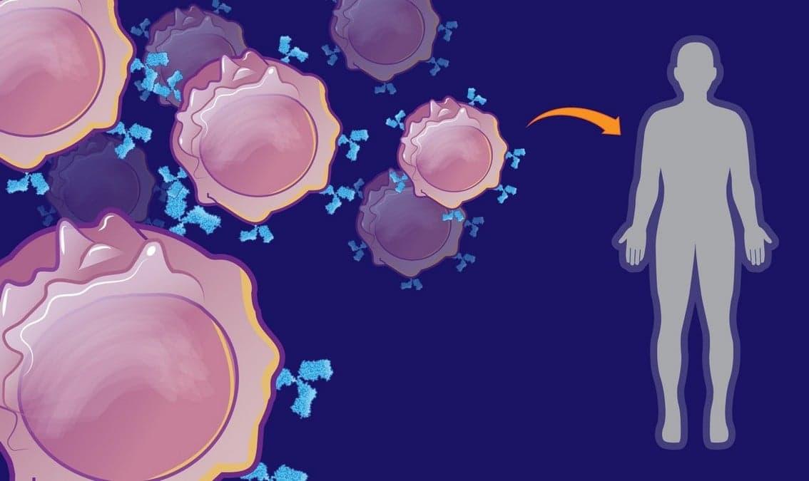 Making a Cell Therapy: Principles and Practice of Manufacturing