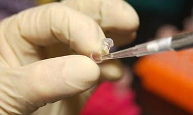 Graph Algorithms in Genome Sequencing