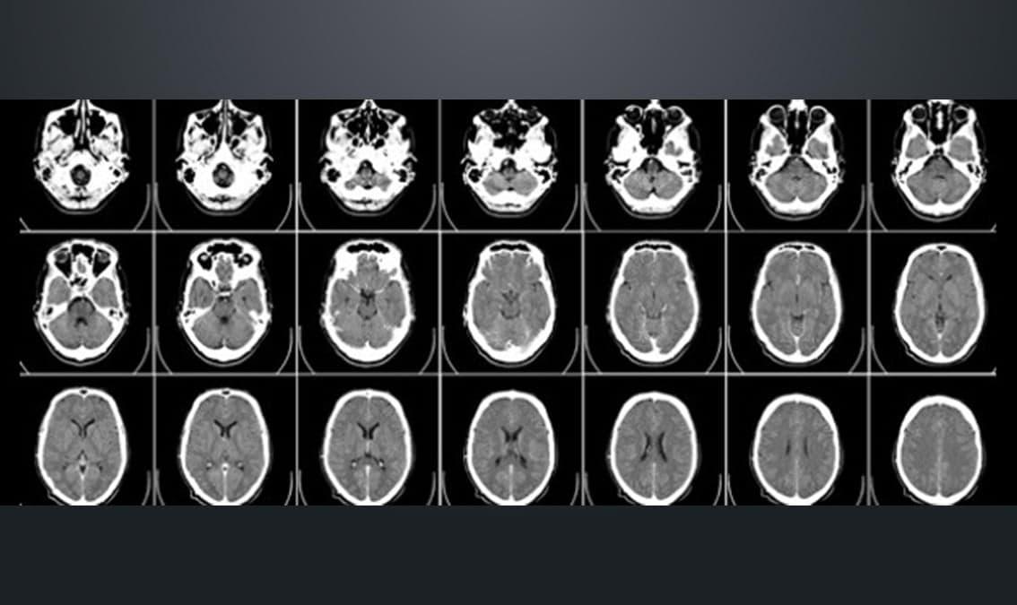 Learning and memory in the brain: a guide for teachers