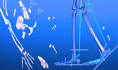 Bipedalism: The Science of Upright Walking