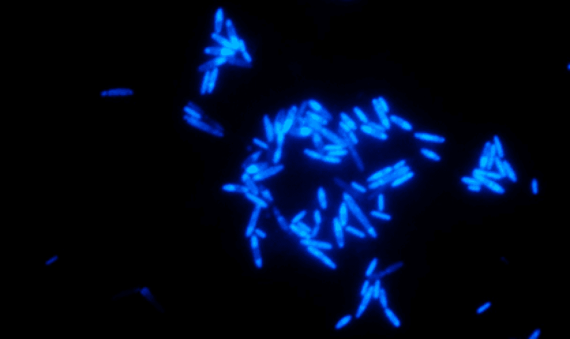 Modern Biotechnologies for Wastewater Treatment