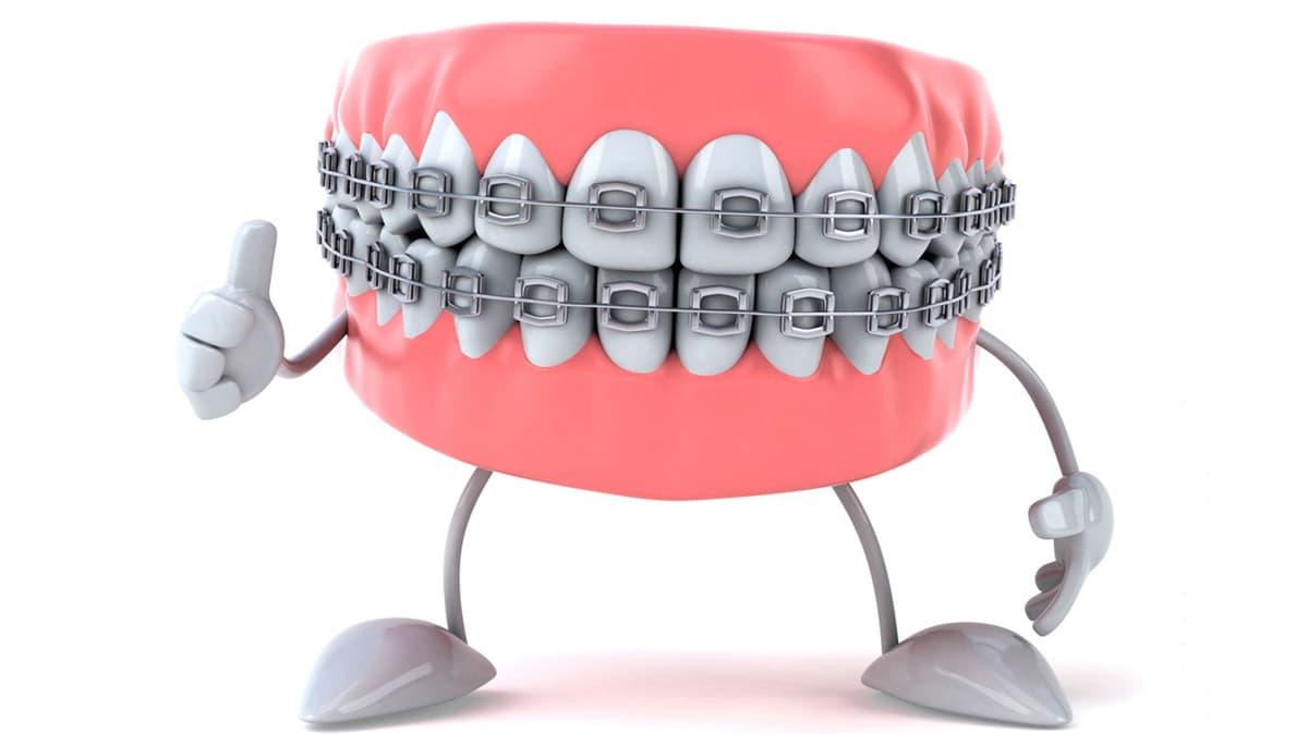 Ortodoncia: tratamientos dentales sencillos para casos complejos